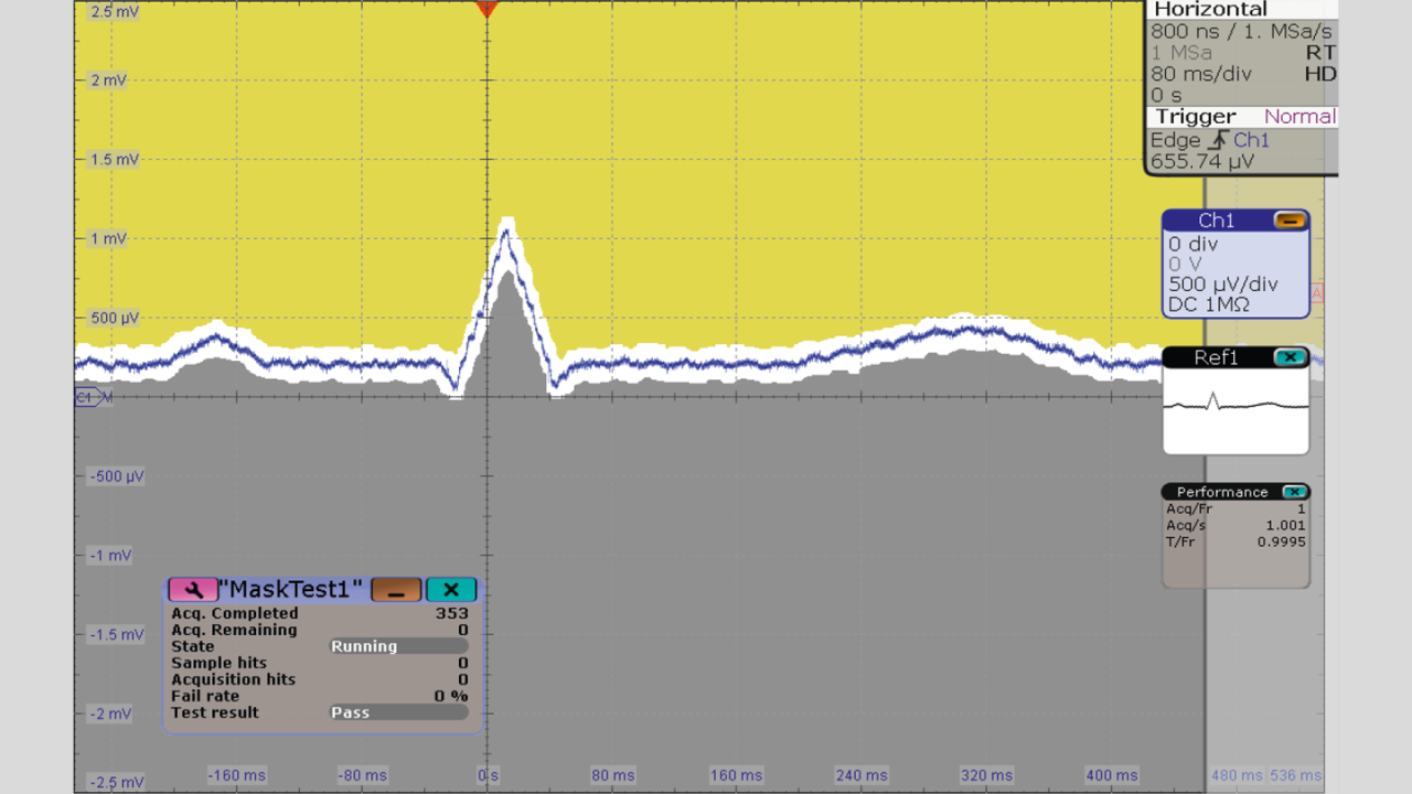 使用 500 μV/div 刻度、HD 模式和模板测试捕捉的 ECG 信号。