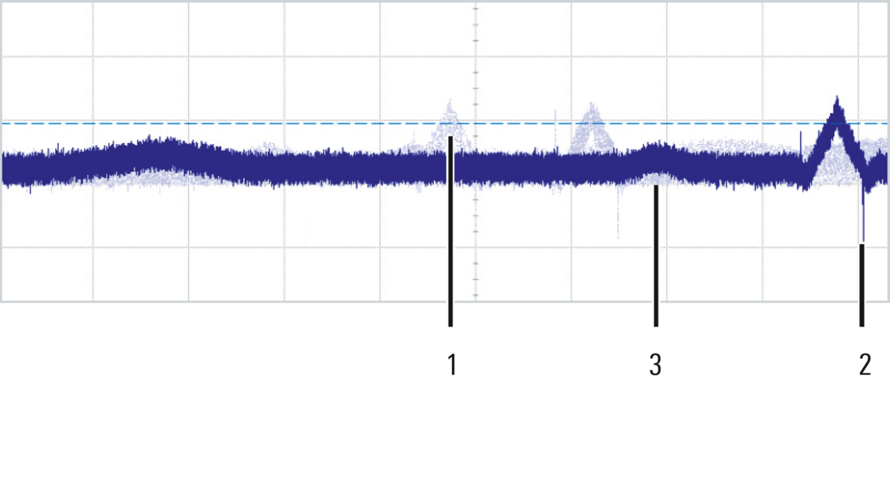 ECG 信号